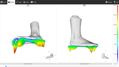 orthotics